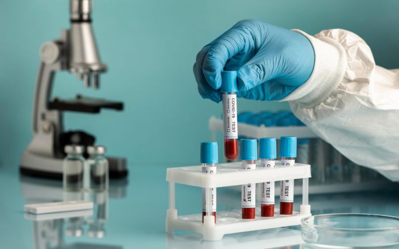 10 Common Pathology Tests