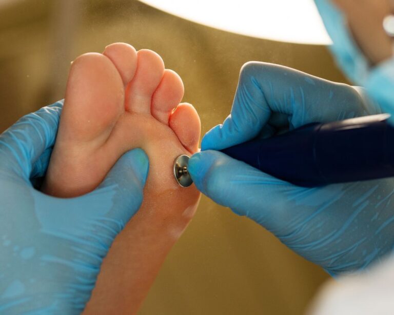 Diabetic Foot Problems