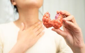 How to Reduce TSH Level in Female